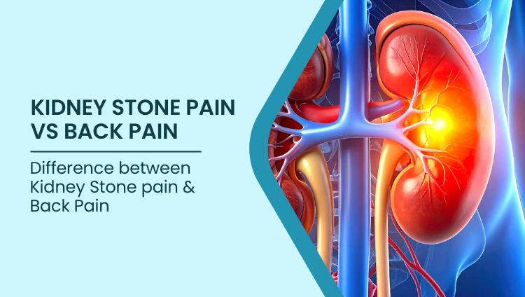 Health blog about Kidney Stone Pain vs Back Pain: Key Differences | Bangalore