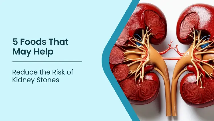 Blog post image for 5 Foods That May Help Reduce the Risk of Kidney Stones