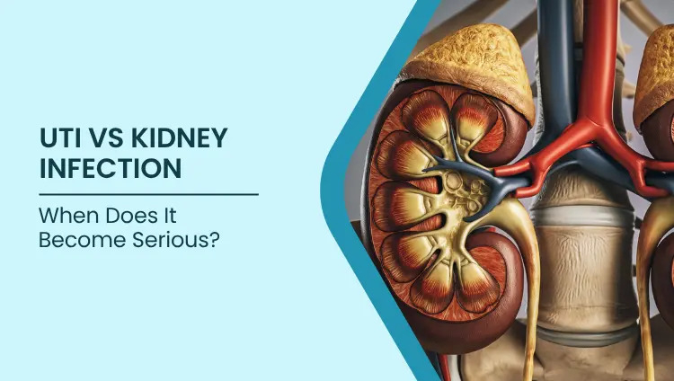 Blog post image for UTI vs Kidney Infection: When Does It Become Serious?