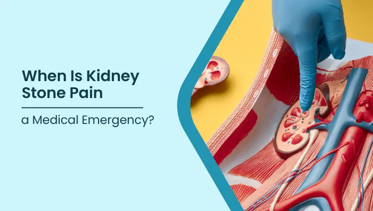 Blog post image for When Is Kidney Stone Pain a Medical Emergency?