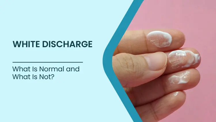 Blog post image for White Discharge: What Is Normal and What Is Not?