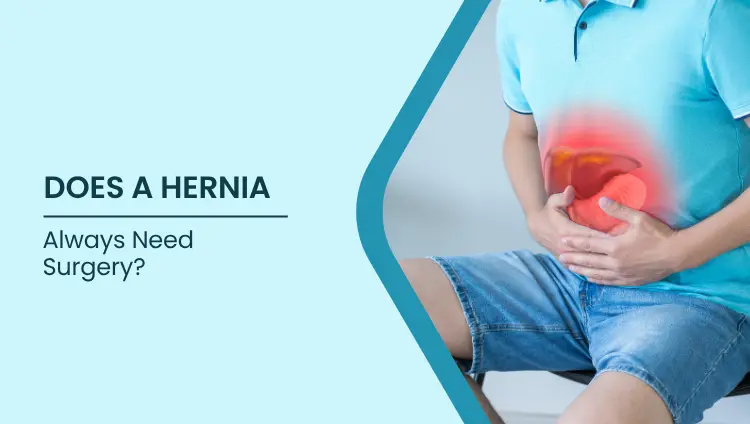 Blog post image for Does a Hernia Always Need Surgery?